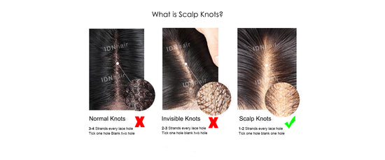 what is scalp knots wig